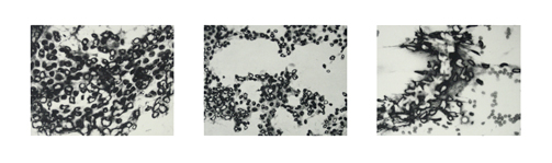 Cancer Cells Series